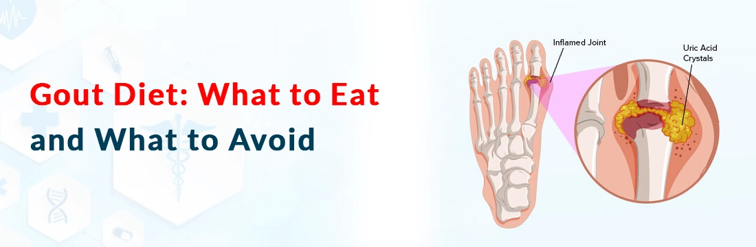  Gout Diet: What to Eat and What to Avoid